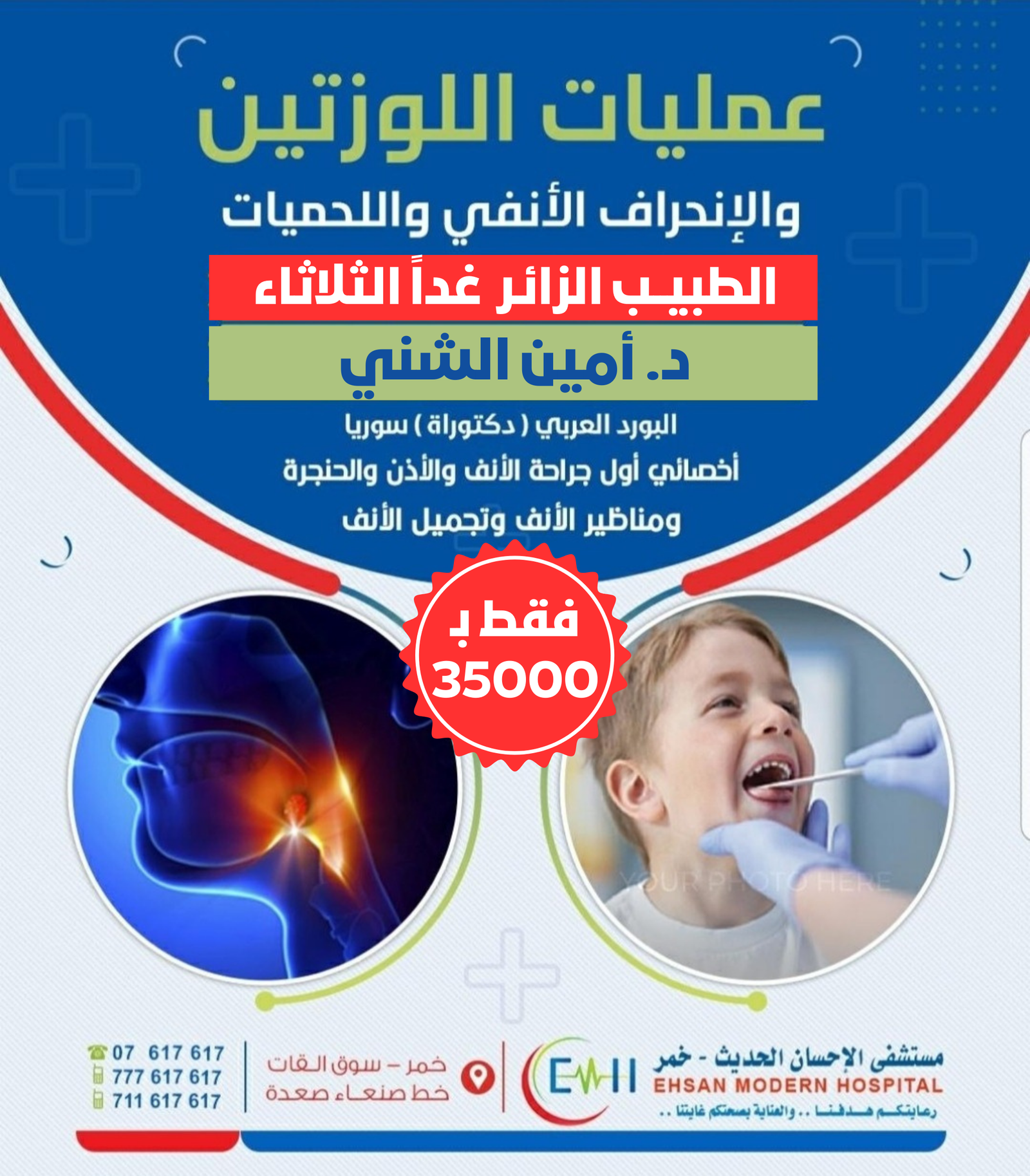 عمليات استئصال اللوزتين